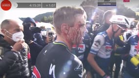 Remco Evenepoel en sang à l'arrivée de la troisième étape de la Vuelta 2023