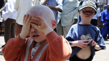 Un petit albinos au Burundi, le 27 février 2009