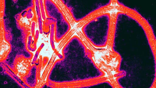 Un échantillon de virus Ebola coloré et mis en lumière à l'aide d'un procédé de micrographie électronique à balayage.