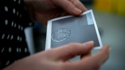 Après la naissance du bébé, le couple s'est mis à douter en constatant qu'il n'était pas de type caucasien comme eux (illustration).