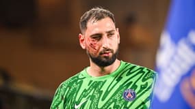 Le visage balafré de Gianluigi Donnarumma après avoir reçu une violente semelle de Wilfried Singo lors de Monaco-PSG (2-4, L1), le 18 décembre 2024
