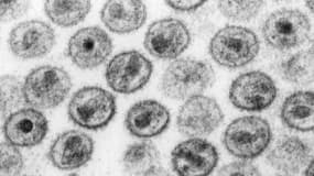 Le VIH vu en microscopie électronique à transmission. PHOTO D'ILLUSTRATION