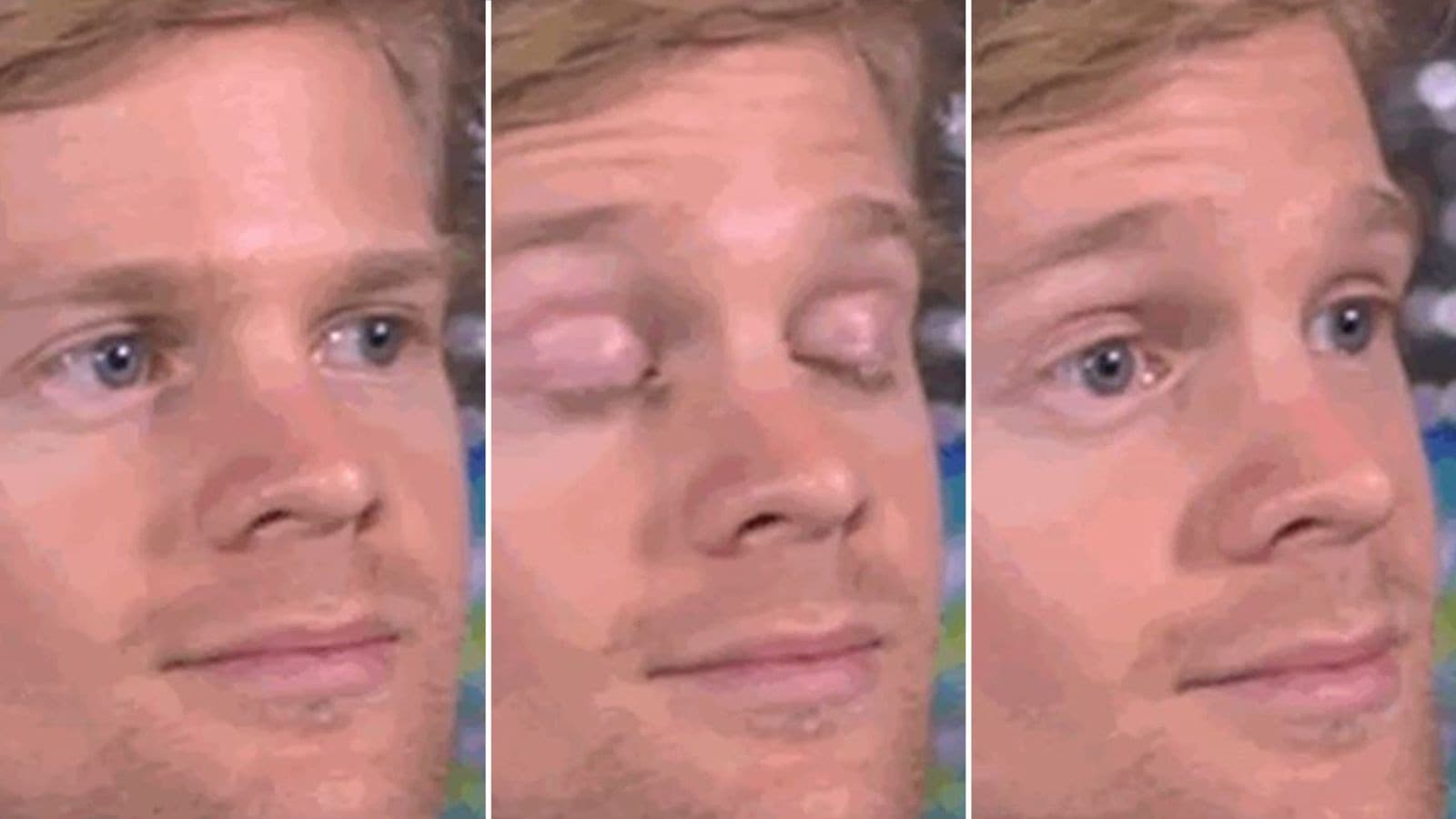 HÉROS DERRIÈRE UN MÈME MONDIALEMENT CONNU, LE "BLINKING WHITE GUY" LÈVE 300.000 DOLLARS CONTRE LA SCLÉROSE EN PLAQUES