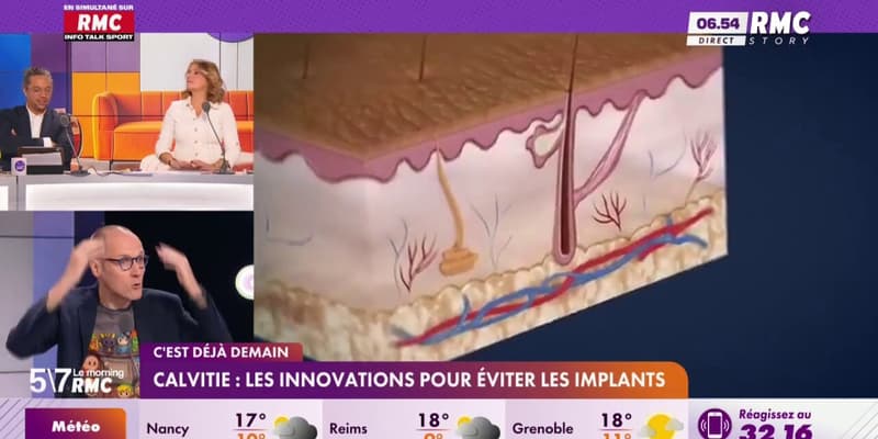 C'est déjà demain - les innovations pour éviter les implants