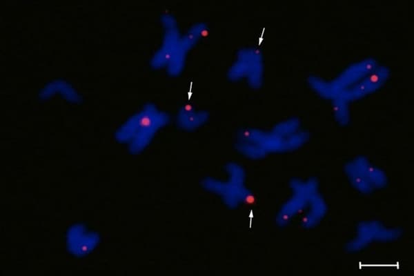 Les quadruples hélices (en rouge) visibles dans les chromosomes humains (en bleu).