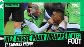 France 1-0 Autriche : Nez cassé pour Mbappé, des examens prévus en vue d'une opération