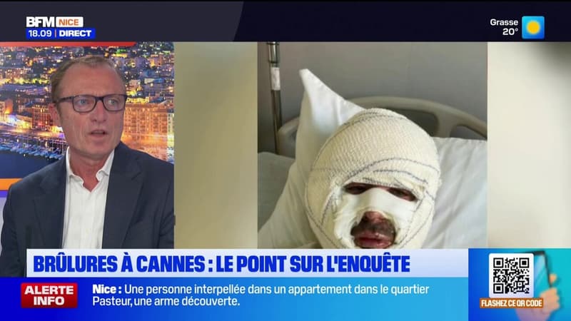 Explosion d'une lampe éthanol à Cannes: cinq mois plus tard, où en est l'enquête?
