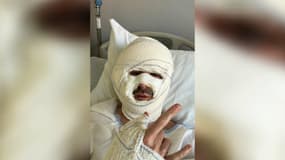 L'une des victimes de l'explosion d'une lampe à éthanol à Cannes.
