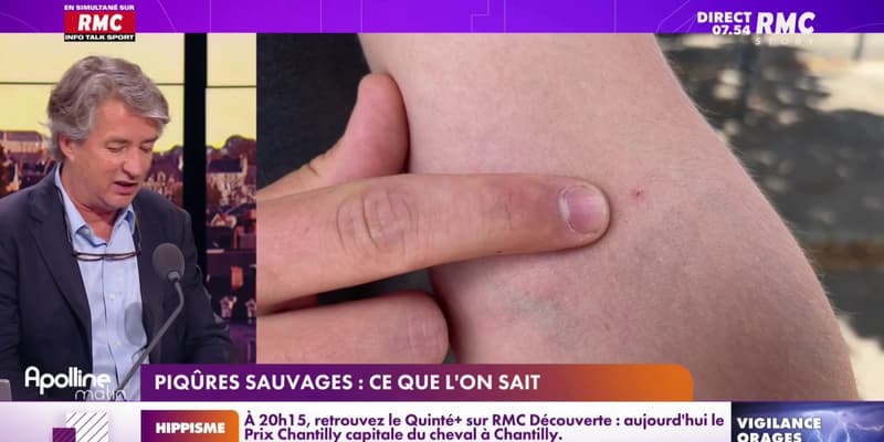 Piqûre
