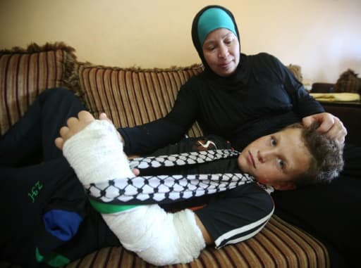 Mohammed Tamimi, 11 ans, dans sa maison à Nabi Saleh, près de Ramallah en Cisjordanie, le 29 août 2015, au lendemain d'affrontements entre les forces de sécurité israéliennes et des manifestants palestiniens