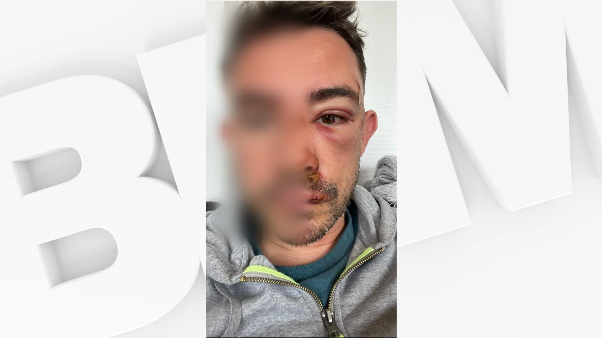 Man recounts violent homophobic attack in Lyon with SOS Homophobia lawyer representation