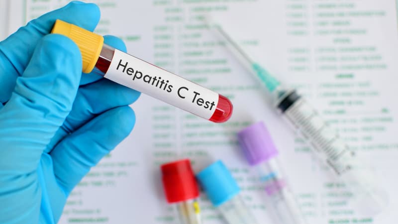 Le virus de l’hépatite C (VHC) est responsable à la fois de l’infection aiguë et de l’infection chronique.