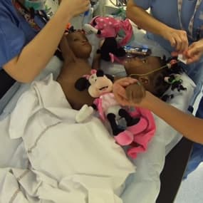 Bissie et Eyenga, deux siamoises camerounaises, ont été séparées à Lyon ce mercredi