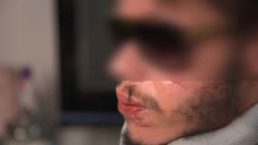 Sofiane, le jeune homme qui accuse un policier de l'avoir blessé le 13 juillet 2022