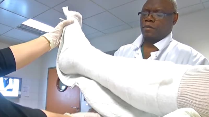 "Une jambe ou un bras cassé, c'est entre 60 et 70.000 euros": l'Institut Montaigne plaide pour responsabiliser les citoyens face aux coûts masqués des services publics