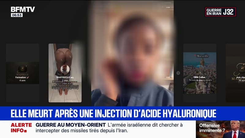 Chirurgie esthétique clandestine: une femme décède après une injection d'acide hyaluronique