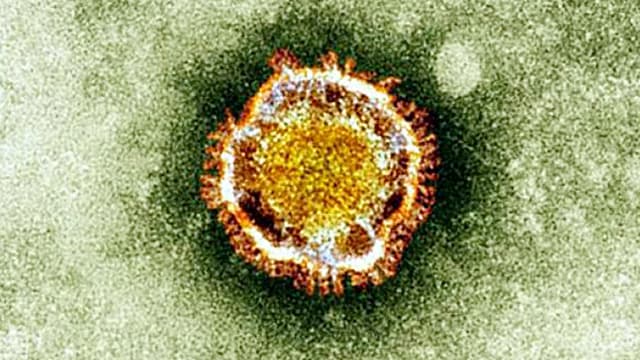 Le coronavirus vu au microscope