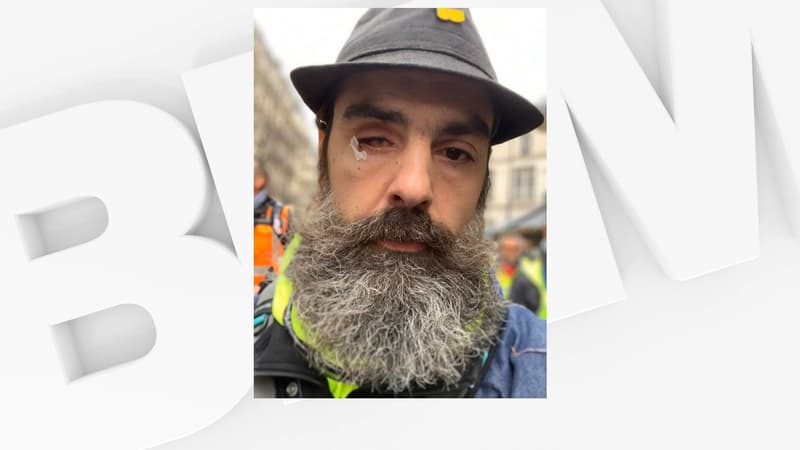 Jérôme Rodrigues blessé à l'oeil lors d'un rassemblement de gilets jaunes contre la réforme des retraites à Paris, le 28 décembre 2019