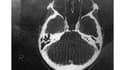 Un cerveau au rayon-X