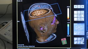 Image d'un cerveau obtenue à partir d'une IRM.