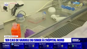 1er cas de variole du singe à l'Hôpital Nord