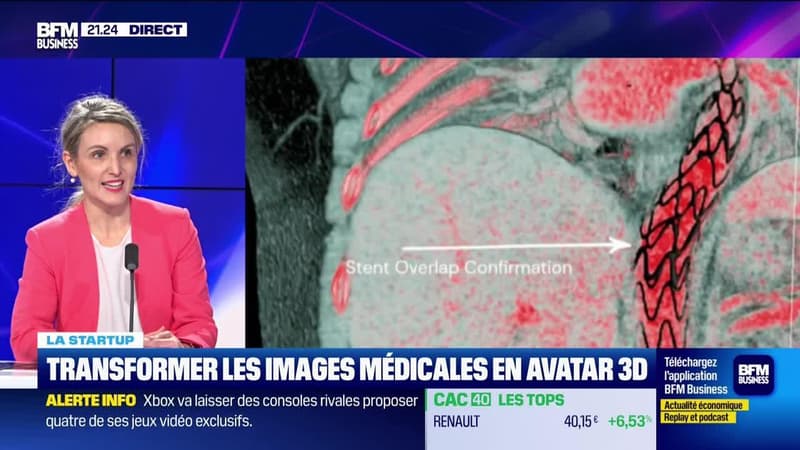 Avatar Medical lève 5 millions d'euros pour démocratiser l'accès aux images médicales 3D - 15/02