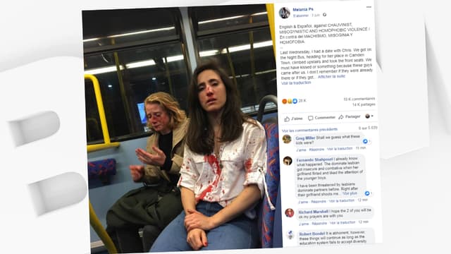 Melania Geymonat a dévoilé sur Facebook la photographie de son visage ensanglanté, et de celui de sa petite amie Chris, après avoir été attaquées dans un bus londonien.