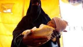A Sanaa, au Yémen, le 9 juin 2017, une mère tient son fils qui pourrait être atteint du choléra
