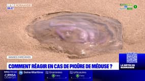 Normandie: comment réagir en cas de piqûre de méduse?